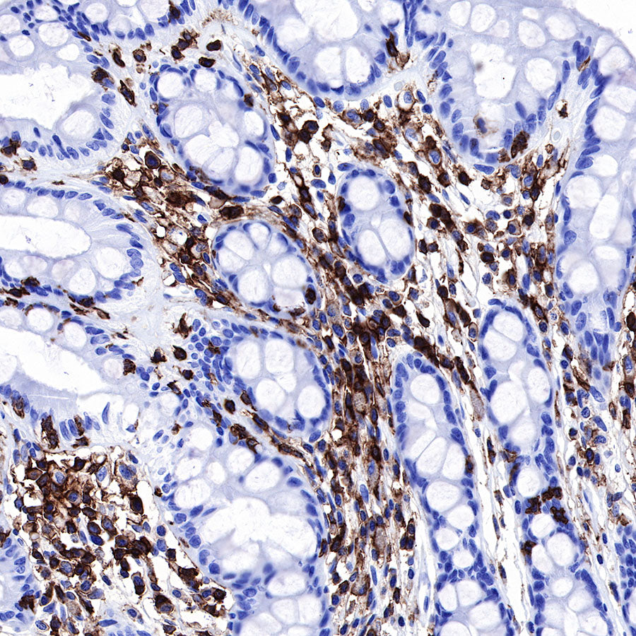 S-RMab® CD45 Recombinant Rabbit mAb,PBS Only (SDT-R035)