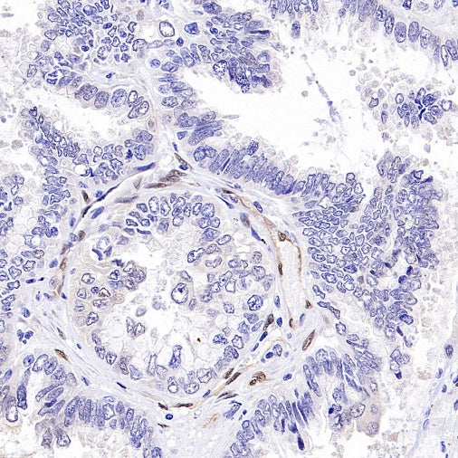 TAZ Recombinant Rabbit mAb (S-2812-102)