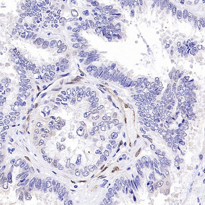TAZ Recombinant Rabbit mAb (S-2812-102)