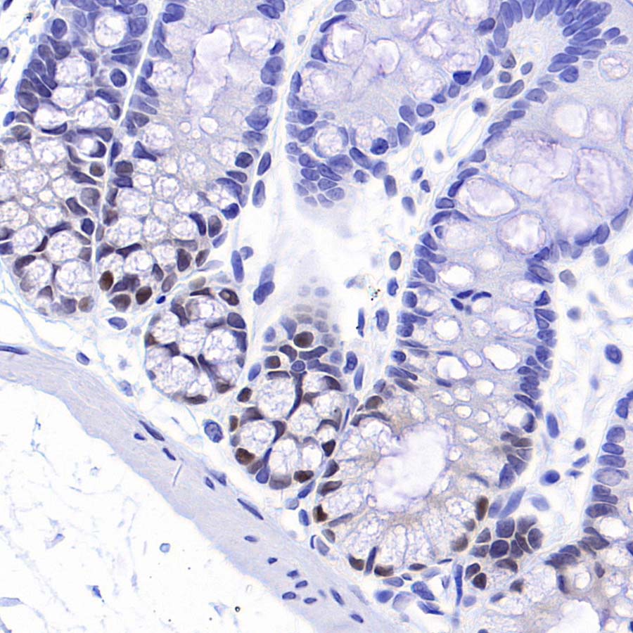 CDK6 Recombinant Rabbit mAb (S-4090-71)