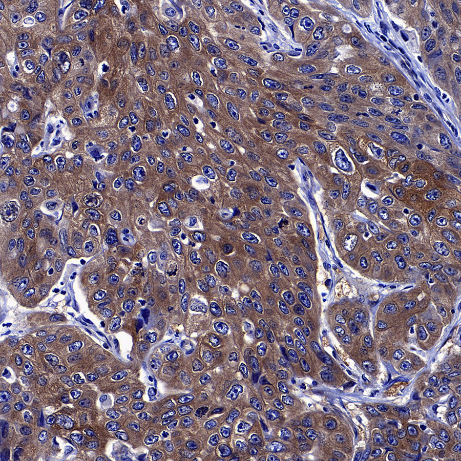 GFPT1 Recombinant Rabbit mAb (S-4752-19)