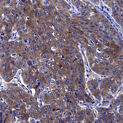 GFPT1 Recombinant Rabbit mAb (S-4752-19)