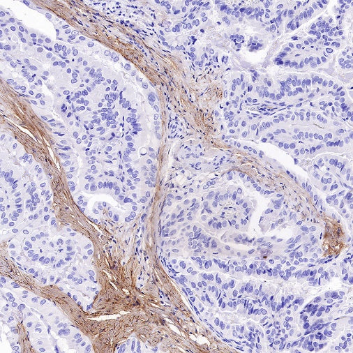 LRRC15 Recombinant Rabbit mAb (S-2473-43)