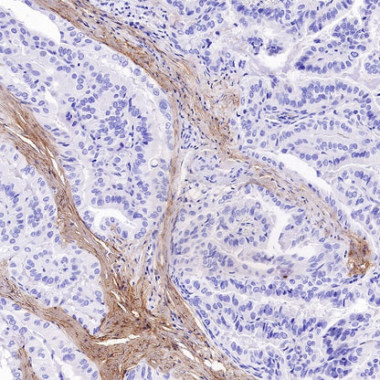 LRRC15 Recombinant Rabbit mAb (S-2473-43)