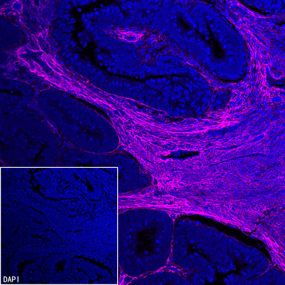 COL3A1 Recombinant Rabbit mAb (S-4338)