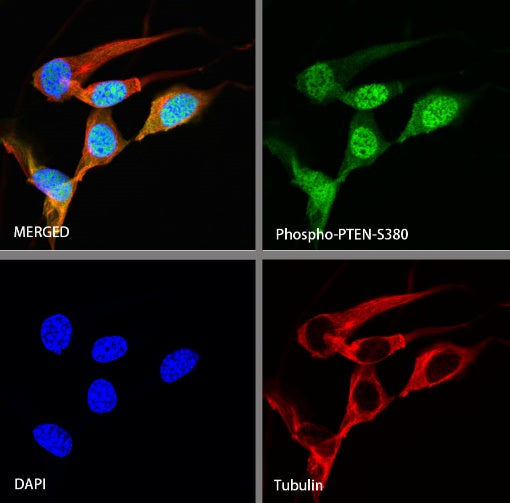 Phospho-PTEN (S380) Recombinant Rabbit mAb (S-1165-163)