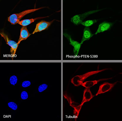 Phospho-PTEN (S380) Recombinant Rabbit mAb (S-1165-163)