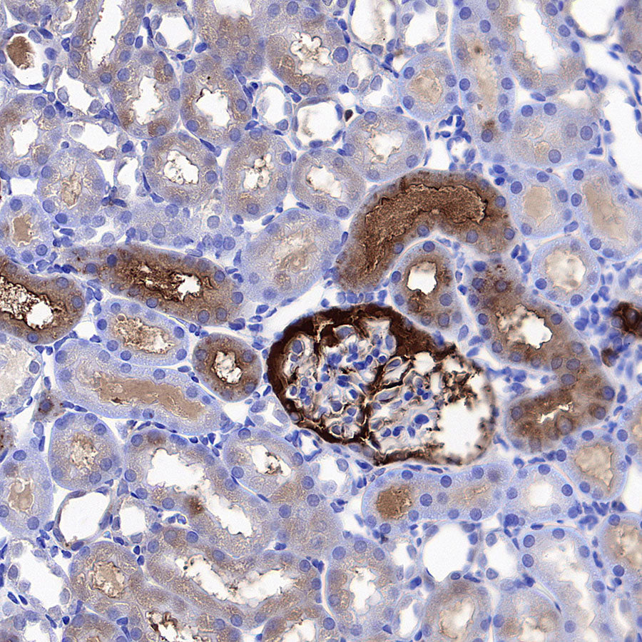 Ferritin Heavy Chain Recombinant Rabbit mAb (S-5419)