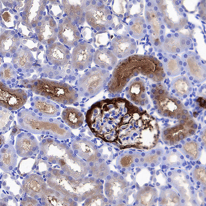 Ferritin Heavy Chain Recombinant Rabbit mAb (S-5419)