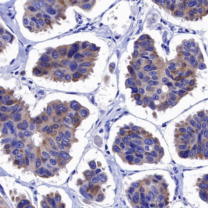 Bim Recombinant Rabbit mAb (S-994-29)