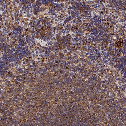 ISL2 Rabbit Polyclonal Antibody