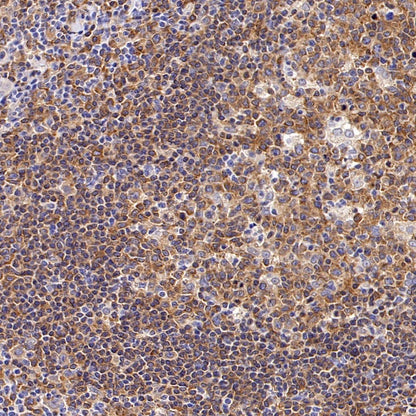 PLCγ2 Recombinant Rabbit mAb (S-2749-14)