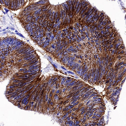 Claudin 3+Claudin 9 Recombinant Rabbit mAb (SDT-1452-69)