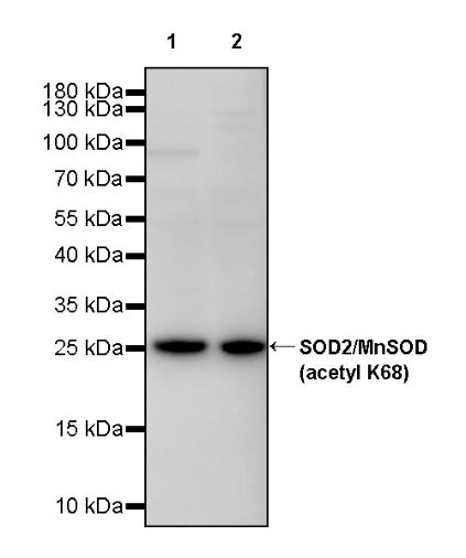 SOD2/MnSOD (acetyl K68) Rabbit Polyclonal Antibody