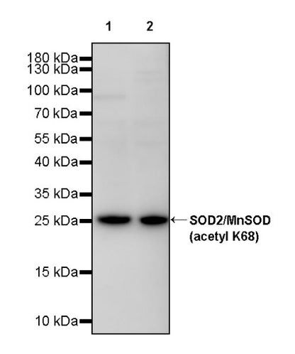 SOD2/MnSOD (acetyl K68) Rabbit Polyclonal Antibody
