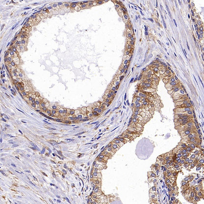 GORASP2 Recombinant Rabbit mAb (S-2526-47)
