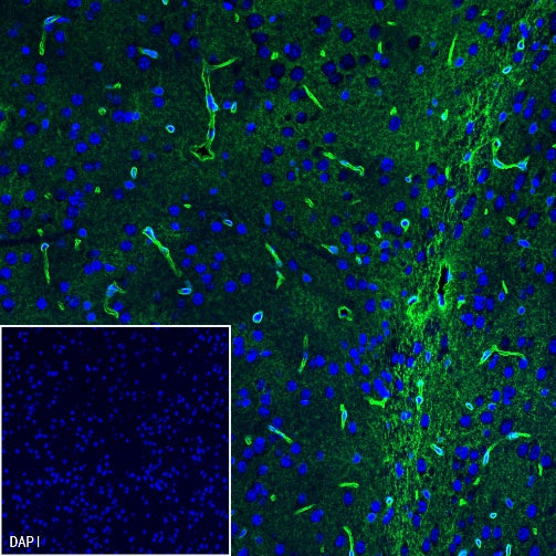 AQP4 Recombinant Rabbit mAb (S-1609-62)