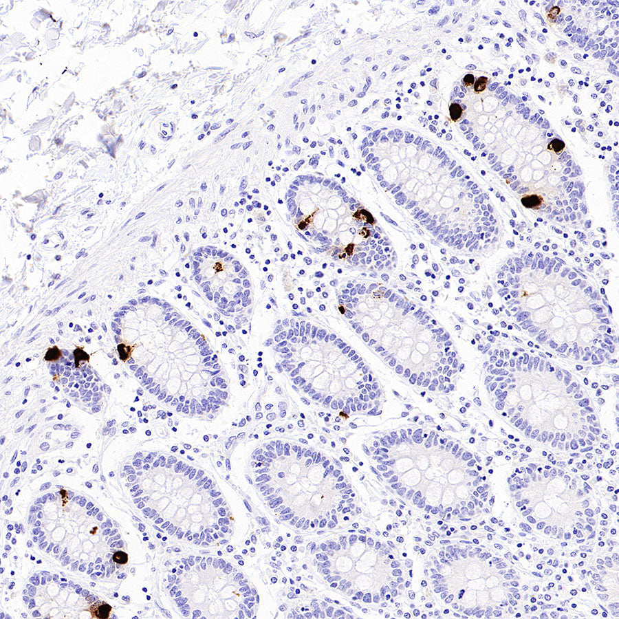 BRN3A Recombinant Rabbit mAb (S-3253-25)