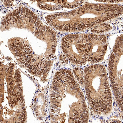 ACLY/ATP citrate lyase Recombinant Rabbit mAb (S-2025-32)