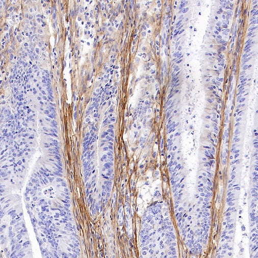 Periostin Recombinant Rabbit mAb (S-2824-17)