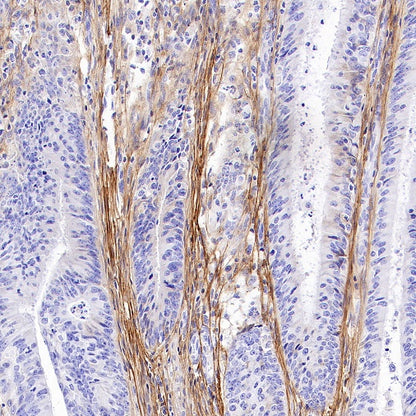 Periostin Recombinant Rabbit mAb (S-2824-17)