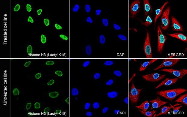 Histone H3 (Lactyl K18) Recombinant Rabbit mAb (S-3217-72)