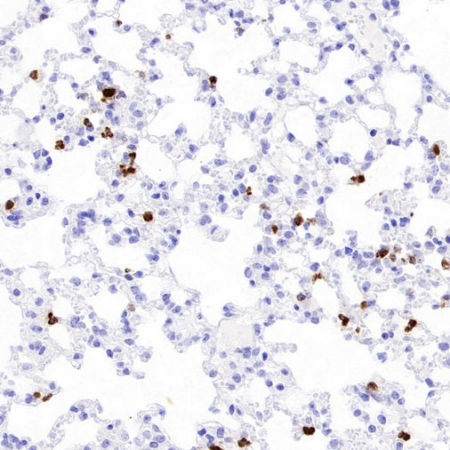 Neutrophil Elastase (ELA2) Recombinant Rabbit mAb (S-3766-3)