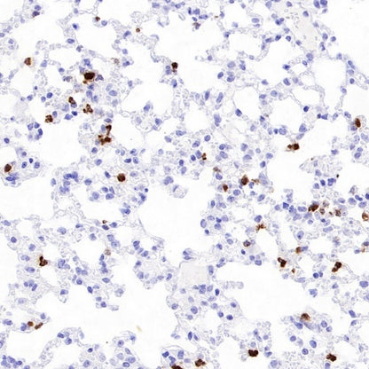 Neutrophil Elastase (ELA2) Recombinant Rabbit mAb (S-3766-3)