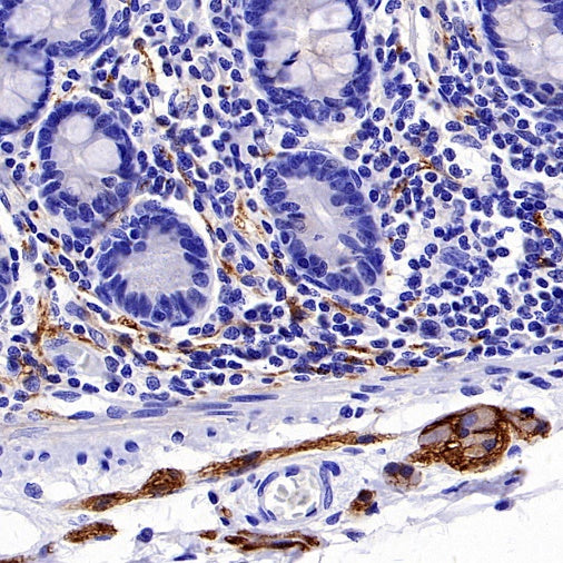 CD56 Recombinant Rabbit mAb (SDT-2427-1)