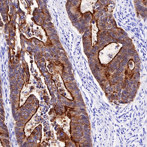 Villin Recombinant Rabbit mAb (SDT-R255)