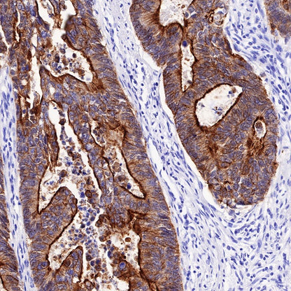 Villin Recombinant Rabbit mAb (SDT-R255)