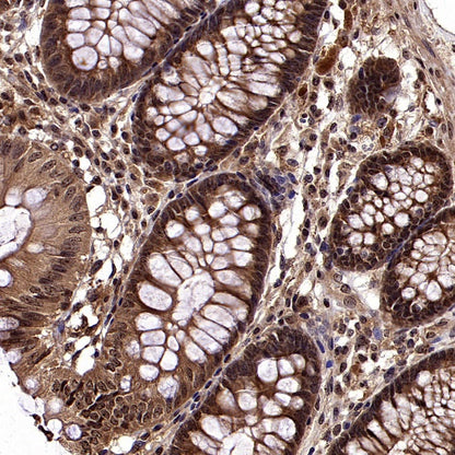 cIAP2 Recombinant Rabbit mAb (S-2483-8)