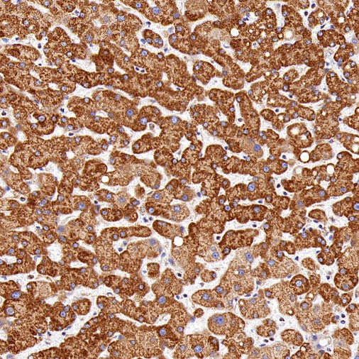 CPT1A Recombinant Rabbit mAb (S-1263-2)
