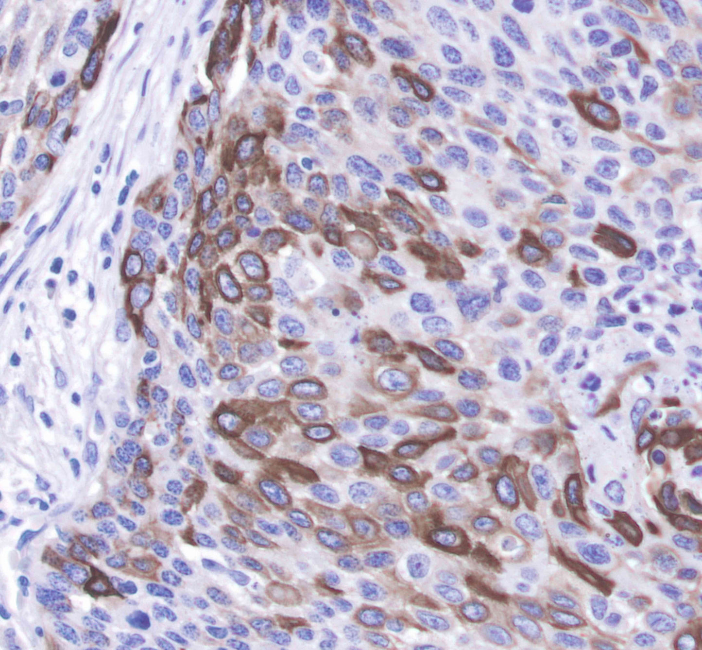 Keratin 14 Recombinant Rabbit mAb(SDT-023-1)