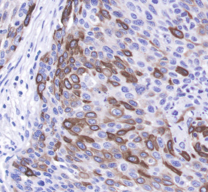 Keratin 14 Recombinant Rabbit mAb(SDT-023-1)