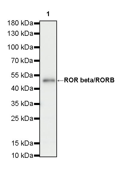 ROR beta/RORB Recombinant Rabbit mAb (S-5483)