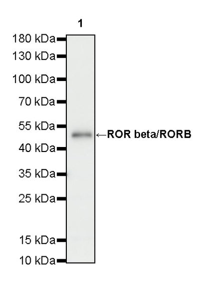 ROR beta/RORB Recombinant Rabbit mAb (S-5483)