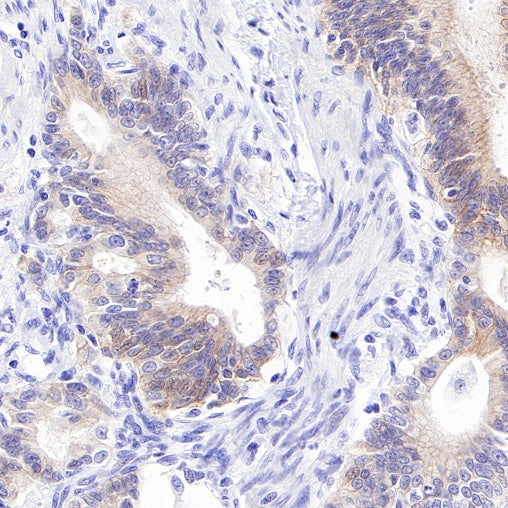 ErbB3 Recombinant Rabbit mAb (SDT-991-14)