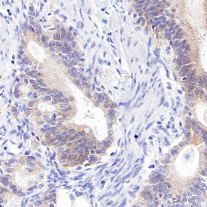ErbB3 Recombinant Rabbit mAb (SDT-991-14)