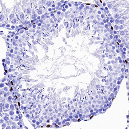SALL4 Recombinant Rabbit mAb (SDT-1484-1)