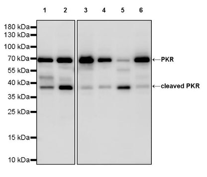 PKR Recombinant Rabbit mAb (S-731-118)