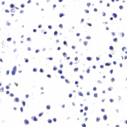 Claudin 9 Recombinant Rabbit mAb (S-2849-16)