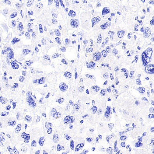 Histone H3.3 G34W Recombinant Rabbit mAb (SDT-6018)