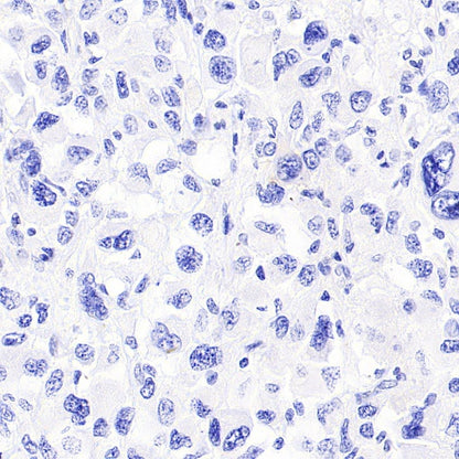 Histone H3.3 G34W Recombinant Rabbit mAb (SDT-6018)