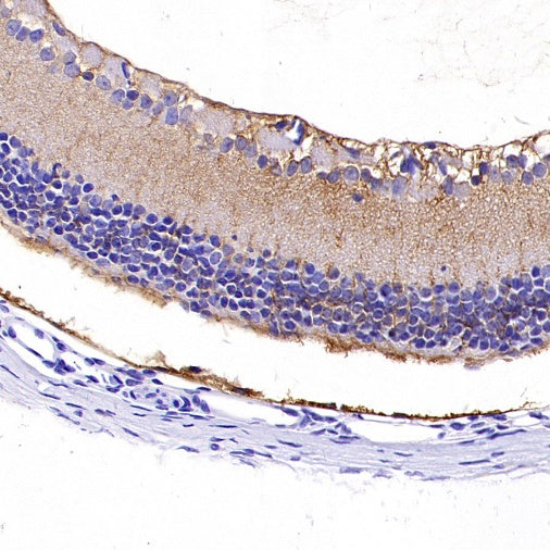 CRALBP Rabbit Polyclonal Antibody
