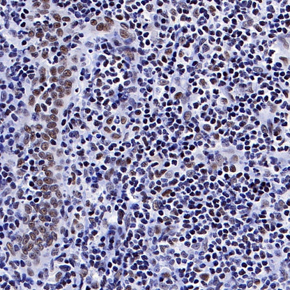 PPARγ Recombinant Rabbit mAb (SDT-556-108)