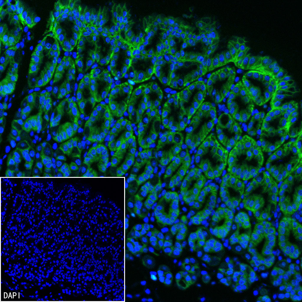 Claudin 18.2 Recombinant Rabbit mAb (FITC Conjugate) (SDT-102-24)