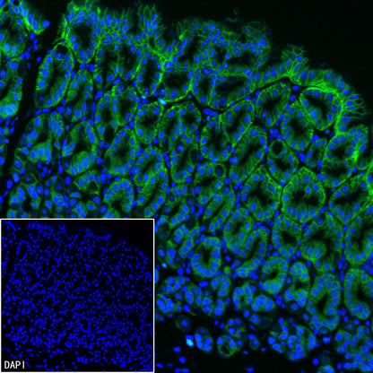 Claudin 18.2 Recombinant Rabbit mAb (FITC Conjugate) (SDT-102-24)
