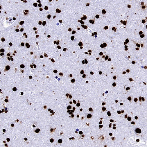 hnRNP U Recombinant Rabbit mAb (S-2375-23)