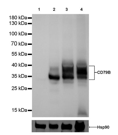 CD79B Recombinant Rabbit mAb(SDT-043-9)